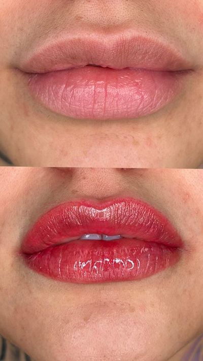 Healed brows, three-quarter view